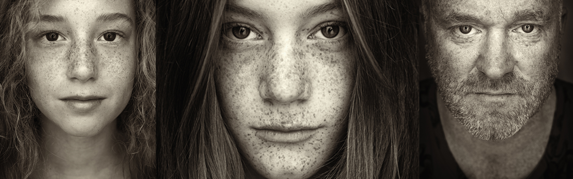 Judith Minks, Freckles, Wammes